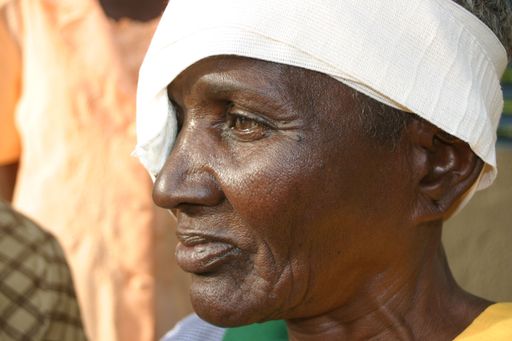 Bari Alima (60) aus dem Dorf Touesi in Burkina Faso wurde nach zwei Jahren Blindheit durch eine Augenoperation in einem Augencamp von LICHT FÜR DIE WELT vom Grauen Star geheilt und kann wieder sehen.