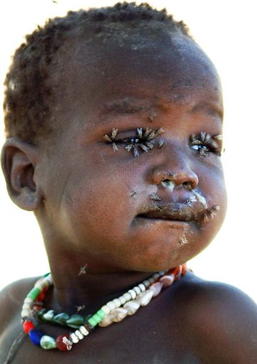 Vorschau Bild von Pressefotopreis Objektiv 07. Siegerbild Kategorie Porträt: "Menschen im Südsudan (Kind mit Fliegen)" von Martin Gnedt.