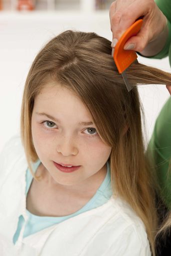 Vorschau Bild von Die neue Generation von Kopflausmitteln wirkt physikalisch. Die Parasiten ersticken.