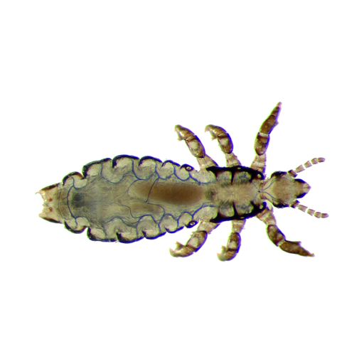 Vorschau Bild von Tracheensystem der Kopflaus in elektronenmikroskopischer Aufnahme nach der Behandlung mit NYDA(R) (blau gefärbt).