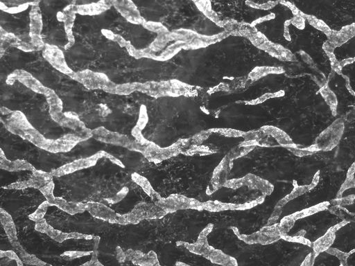  Für eine schnelle Verbindung nach draußen: die hell angefärbten Lymphgefäße  weisen Immunzellen den Weg aus dem Gewebe (Mikroskopische Aufnahme, Immunfluoreszenz)