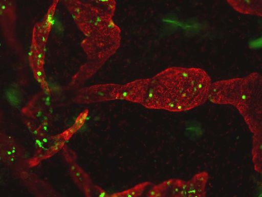 Vorschau Bild von Zellen des Immunsystems (dendritische Zellen, grün dargestellt) werden von Lymphgefäßen angelockt und aus dem Gewebe befördert.