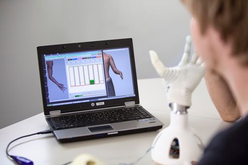 Hi-Tech Prothesen: Individuelle Bewegungsmustererkennung hilft bei der Steuerung