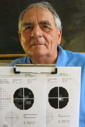  Embolie im Auge. Erblindung erfolgreich bekämpft.