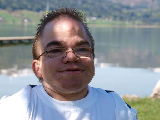Vorschau Bild von Manche MPS-Patienten werden zwar erwachsen,
entwickeln aber dennoch schwere körperliche Behinderungen.