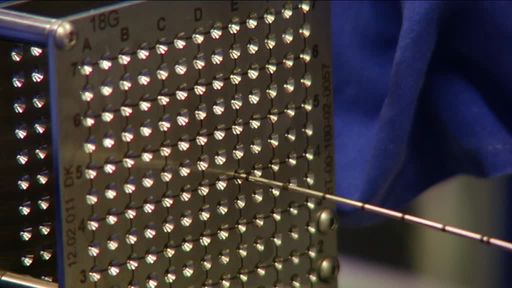 Vorschau Bild von Heidelberger Klinik für Prostata-Therapie nutzt
erstmals die Irreversible Elektroporation zur schonenden Behandlung
von Prostata-Krebs. Bei der Irreversiblen Elektroporation werden
Elektroden durch eine Art Metallschablone, millimetergenau in die
Prostata eingeführt und dort um den Tumor herum positioniert.