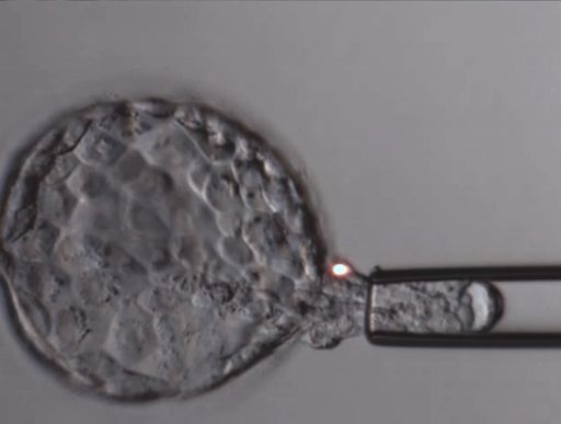  Durchführung einer Trophoblastbiopsie
