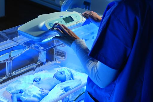 Gelbsucht bei Neu- und Frühgeborenen behandeln: Die
Phototherapieleuchte BiliLux wandelt den Farbstoff Bilirubin in eine
wasserlösliche Substanz um.
