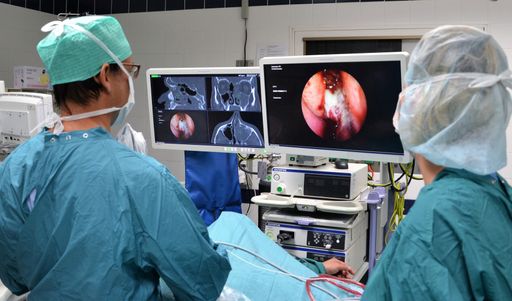 Mikrochirurgischer Eingriff mit dem neuen
3D-Navigationsgerät in der Privatklinik Döbling. Hier wird gerade
eine Nasennebenhöhle saniert.
