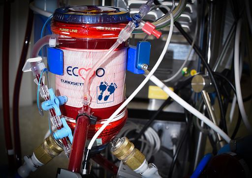 Vorschau Bild von Extrakorporale Unterstützung zur teilweisen oder
gänzlichen Übernahme der Lungen- bzw. Herzfunktion für die kleinen
Patienten