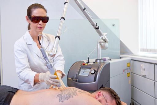  Tattooentfernung mit Laser bei Aestomed Wien