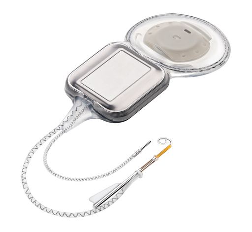 Vorschau Bild von Cochlea-Implantat gegen hochgradigen Hörverlust