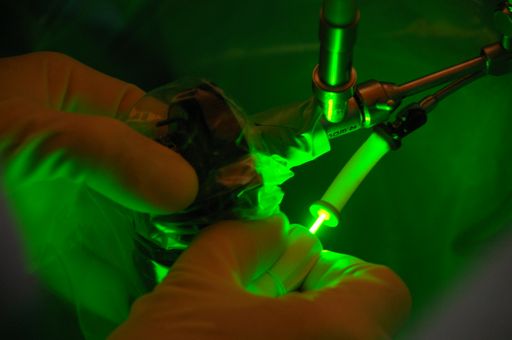 Die an der Klinik für Prostata-Therapie in Heidelberg
praktizierte Greenlightlaser-Therapie bei Prostatavergrößerungen
kann entscheidend zum Erhalt der Sexualfunktionen beitragen.
Weiterer Text über ots und www.presseportal.de/nr/57328 / Die
Verwendung dieses Bildes ist für redaktionelle Zwecke honorarfrei.
Veröffentlichung bitte unter Quellenangabe: "obs/Klinik für
Prostata-Therapie Heidelberg/M. Boeckh"