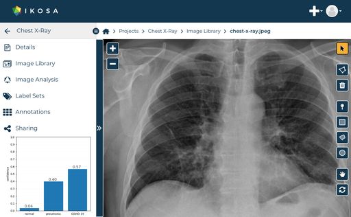  Screenshot von KML Vision Onlineplattform IKOSA®
mit einem analysierten Röntgenbild