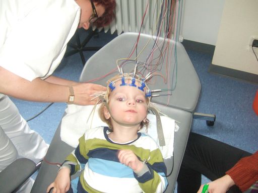  EEG-Ableitung bei einem Kind mit massivem Hirnschaden,
Zerebralparese und Koma vor der Stamzellbehandlung aus eigenem
(autologen) Nabelschnurblut. Fünf Jahre nach der Stammzellbehandlung
wurde der Junge in die Grundschule aufgenommen, die er seither
erfolgreich besucht (Jensen und Hamelmann, 2013, Jensen, 2014). /
Weiterer Text über ots und www.presseportal.de/nr/148654 / Die
Verwendung dieses Bildes ist für redaktionelle Zwecke honorarfrei.
Veröffentlichung bitte unter Quellenangabe: "obs/BrainRepair
UG/Prof. Dr. Arne Jensen"