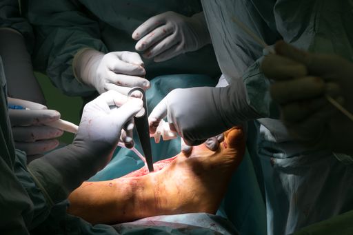 Vorschau Bild von Die Bohrschablone wird aufgesetzt.