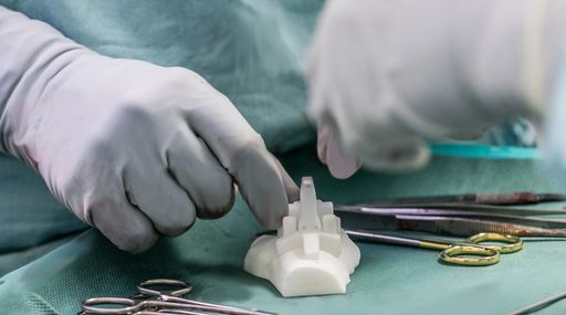 Vorschau Bild von Die Schablone aus dem 3D-Drucker ermöglicht einen
passgenauen Einsatz der Sprunggelenksprothese