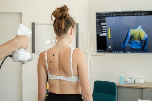 Vorschau Bild von Ob bei der Skoliose-, Prothesen- oder
Orthesenversorgung: Dank der modernen Scan-Technologie ist eine
berührungslose, präzise Maßabnahme möglich