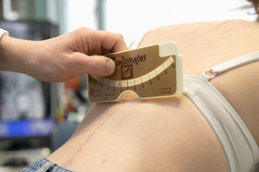 Das Ergebnis der Operation wird mit dem Skoliometer
gemessen
