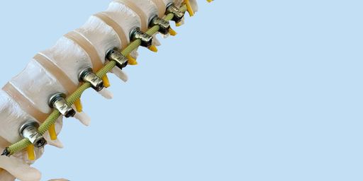 Vorschau Bild von Das Seil befestigt die Wirbelabschnitte, sorgt aber
gleichzeitig für maximal mögliche Beweglichkeit und Flexibilität