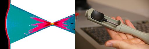 Vorschau Bild von Auch mit hochfokussiertem Ultraschall, der von einem Schallkopf
im Enddarm ausgesandt wird, kann eine fokale Tumorbehandlung
erfolgen. Bei hohen Temperaturen im Brennpunkt des Ultraschalls
koaguliert das Gewebe. / Weiterer Text über ots und
www.presseportal.de/nr/57328 / Die Verwendung dieses Bildes ist für
redaktionelle Zwecke unter Beachtung ggf. genannter
Nutzungsbedingungen honorarfrei. Veröffentlichung bitte mit
Bildrechte-Hinweis.