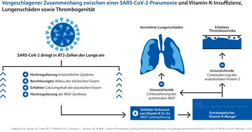 Zusammenhang zwischen einer SARS-CoV-2-Pneunomie und
Vitamin-K-Insuffizienz, Lungenschäden sowie Thrombogenität /
Weiterer Text über ots und www.presseportal.de/nr/113214 / Die
Verwendung dieses Bildes ist für redaktionelle Zwecke unter
Beachtung ggf. genannter Nutzungsbedingungen honorarfrei.
Veröffentlichung bitte mit Bildrechte-Hinweis.