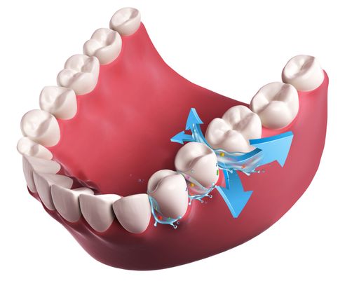 3d rendered illustration of a tooth check