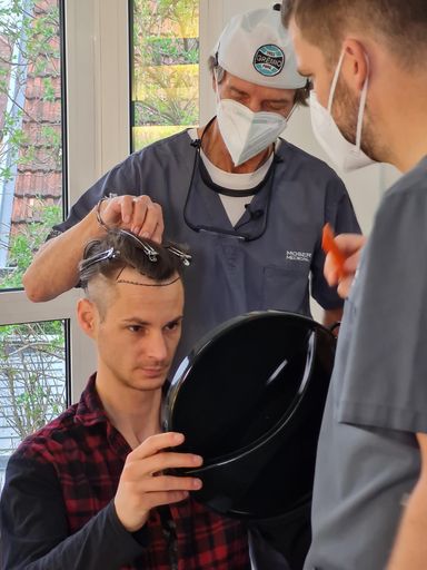 Vorschau Bild von Einzeichnung der Stirnhaargrenze bei Manuel Fettner
vor seiner Eigenhaarverpflanzung