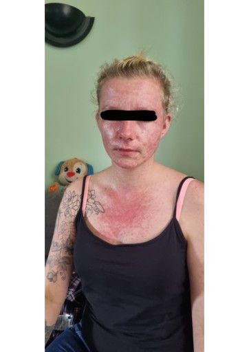 Vorschau Bild von Auch ein halbes Jahr nach der Impfung leidet die 25-jährige Alleinerzieherin noch immer an Impfnebenwirkungen.