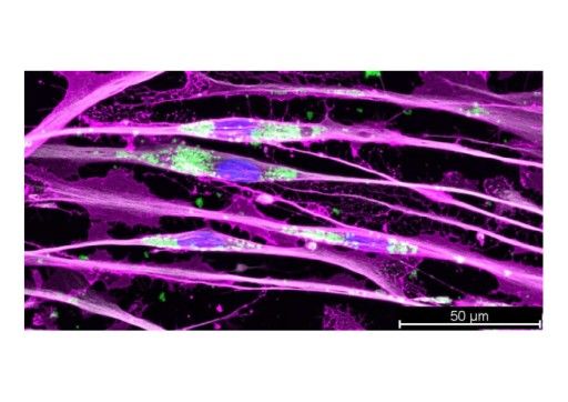 Vorschau Bild von Abbildung: Phagozytose-Potenzial als Teil der Entzündungsreaktion von Schwann-Zellen im „Reparatur“-Modus. (Originalbild aus Figure 1C der Publikation: Jakob Berner, Tamara Weiss, et al., Glia 2022)