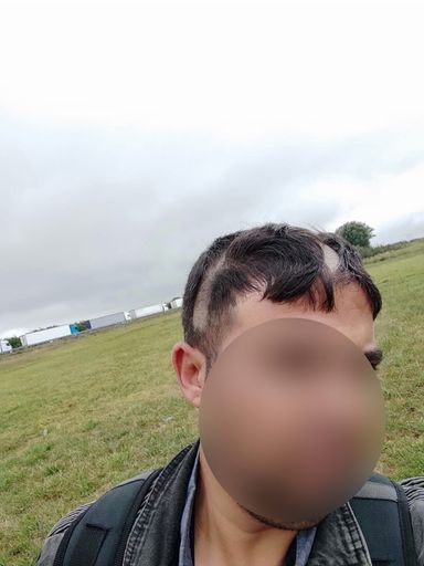 Vorschau Bild von Ungarische Grenzpolizei schlägt und zwangsrasiert
Menschen auf der Flucht