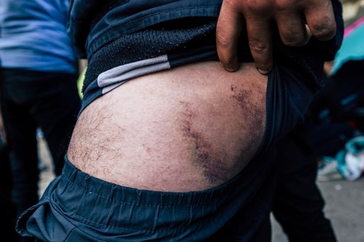 "Die österreichische Polizei hat mich getreten,
mein Handy zerstört und nach Serbien zurückgeschlagen": So die
Behauptung des 22-jährigen Marokkaners, der seit 6 Monaten in
Serbien festhängt.