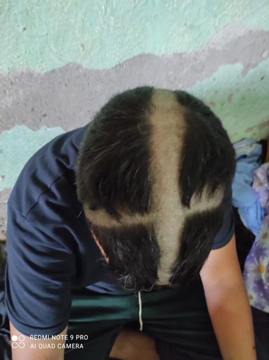 Vorschau Bild von Orbans "Kreuzzug": Die serbische NGO KlikAktiv
dokumentierte vor kurzem einen anderen Fall, bei dem die ungarische
Polizei einem Marokkaner ein Kreuz in die Haare geschnitten haben
soll.