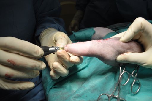 Vorschau Bild von Schnappschuß während der Operation