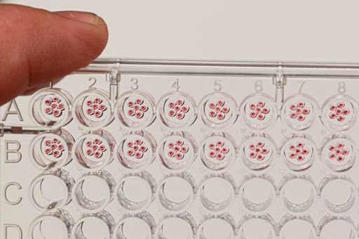 Vorschau Bild von Mulekular Devices in Puch bei Salzburg. BAB 400 ist
in der Lage, komplexe 3D-Zell- und Gewebesysteme mit Präzision und
Wiederholgenauigkeit zu bewältigen, was die Erstellung sehr
komplexer Organoid-Modellsysteme ermöglicht. Damit sind in Zukunft
bessere biologische Ergebnisse zu erzielen, die so zu einer
effektiveren Behandlung von Krankheiten beim Menschen führt.