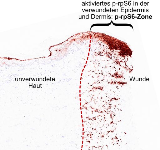  Mithilfe der p-rpS6-Zone kann die Tiefe einer
Hautverletzung genau gemessen werden. Die Zone erscheint innerhalb
von Minuten nach der Verletzung und bleibt während des gesamten
Heilungsablaufes sichtbar.
