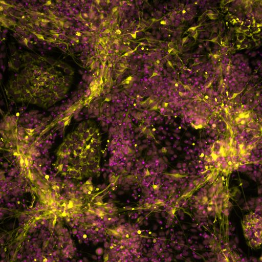  Mit fluoreszierenden Stoffen markierte, mutierte
Stammzellen, die sich zu sympathischen Neuronen differenzieren.