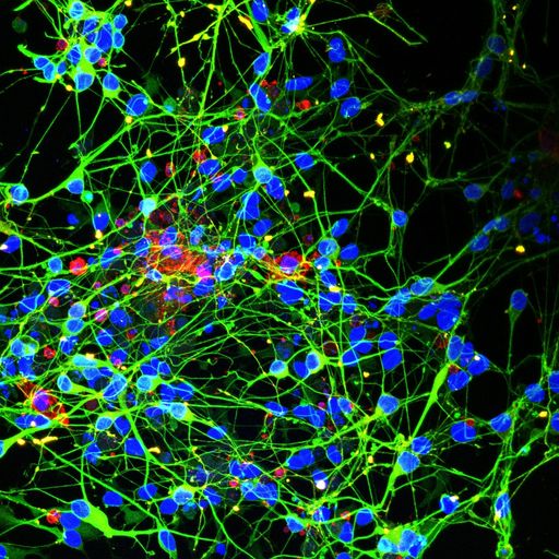 Vorschau Bild von Aus iPS Zellen differenzierte Neuronen (in grün) in Ko-Kultur mit
Mikroglia Zellen (rot)