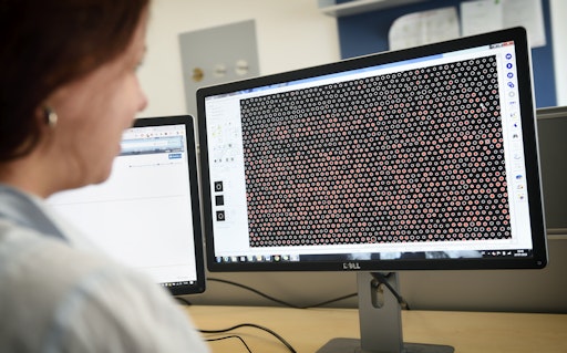 Wissenschaftlerin wertet Daten in der Bioinformatik aus