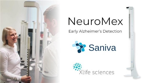 NeurMex revolutioniert die Früherkennung von Alzheimer. //
Weiterer Text über ots und www.presseportal.de/nr/181560 / Die
Verwendung dieses Bildes für redaktionelle Zwecke ist unter
Beachtung aller mitgeteilten Nutzungsbedingungen zulässig und dann
auch honorarfrei. Veröffentlichung ausschließlich mit
Bildrechte-Hinweis.