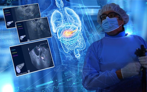 Vorschau Bild von Dr. Leonardo Sosa Valencia, Clinical Gastroenterologist,
Digestive Echo Endoscopist, Medical Staff Manager at IHU,
Strasbourg, France copyright: Medi-Globe GmbH // Weiterer Text über
ots und www.presseportal.de/nr/142441 / Die Verwendung dieses Bildes
für redaktionelle Zwecke ist unter Beachtung aller mitgeteilten
Nutzungsbedingungen zulässig und dann auch honorarfrei.
Veröffentlichung ausschließlich mit Bildrechte-Hinweis.