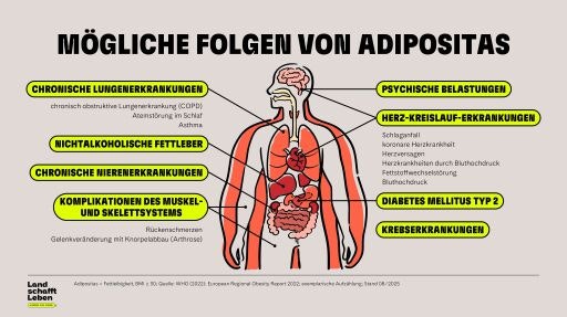 Vorschau Bild zu OTM
