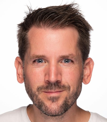 Prof. Dr. Matthias Brendel, Stellvertretender Direktor, Klinik
und Poliklinik für Nuklearmedizin LMU Munich